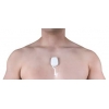 Mypatch Kablosuz Ritim Holter